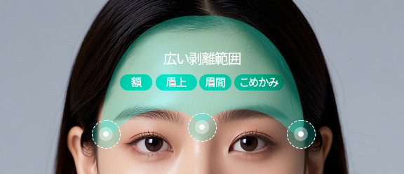 広い剥離範囲